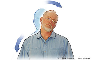 Picture of neck stretch to ease neck fatigue