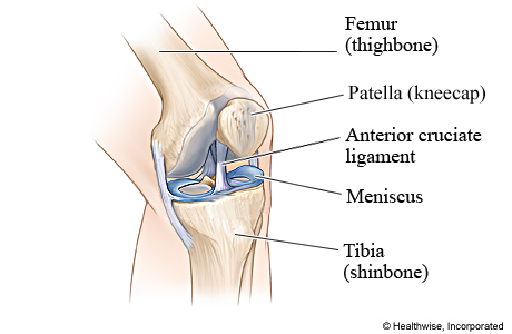 Picture of the anterior cruciate ligament (ACL)