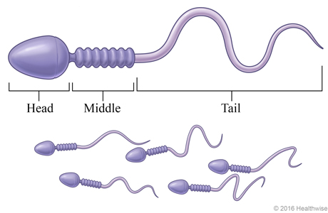 A group of sperm, with detail of a single sperm.