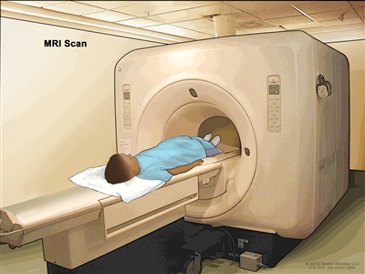 Magnetic resonance imaging (MRI) scan; drawing shows a child lying on a table that slides into the MRI machine, which takes a series of detailed pictures of areas inside the body.