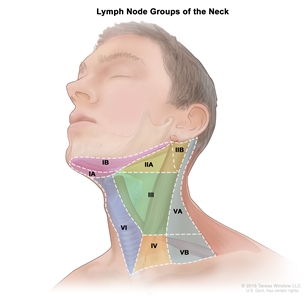 Lymph node groups of the neck; drawing shows six groups of lymph nodes in the neck: group IA and IB, group IIA and IIB, group III, group IV, group VA and VB, and group VI.