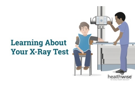 Learning About Your X-Ray Test