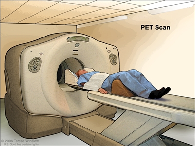 PET (positron emission tomography) scan; drawing shows patient lying on table that slides through the PET machine.