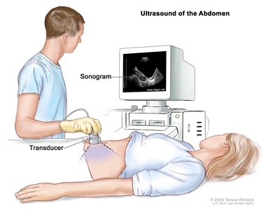 Abdominal ultrasound; drawing shows a woman on an exam table during an abdominal ultrasound procedure. A diagnostic sonographer (a person trained to perform ultrasound procedures) is shown passing a transducer (a device that makes sound waves that bounce off tissues inside the body) over the surface of the patient's abdomen. A computer screen shows a sonogram (computer picture).