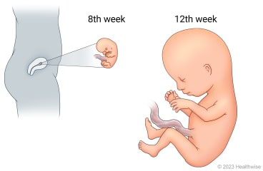 Development of embryo in uterus at 8th week and fetus at 12th week.