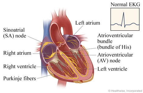 Heart and the pathways for electrical impulses, with normal EKG results.