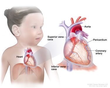 Anatomy of the heart; a pullout shows the aorta, superior vena cava, pericardium, coronary artery, and inferior vena cava.