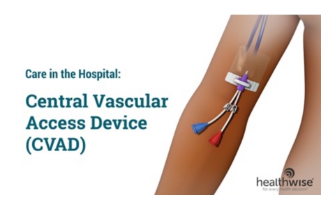 Care in the Hospital: Central Vascular Access Device (CVAD)