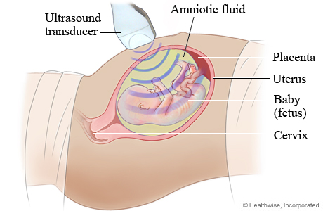 Fetal ultrasound