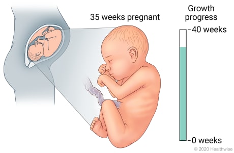 Fetus in uterus, with detail of development at 36 weeks pregnant