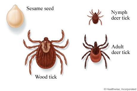 Wood and deer ticks