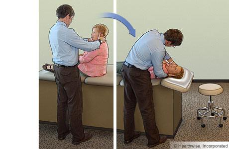 Epley maneuver: Step 1 Epley maneuver: Step 1