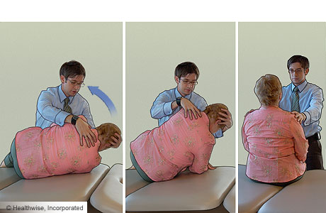 Epley maneuver: Step 4 Epley maneuver: Step 4