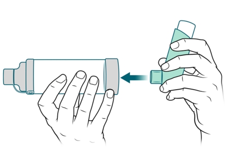 Mouthpiece of inhaler being placed into spacer.