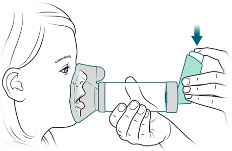 Person pressing down on inhaler to spray medicine into spacer.