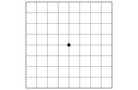 Normal Amsler grid.