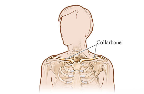 Picture of the collarbone (clavicle)