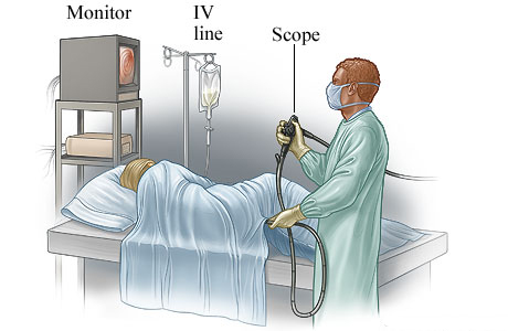 A person having a colonoscopy