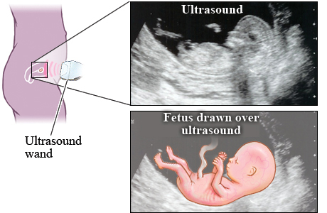 Image and picture of fetal ultrasound