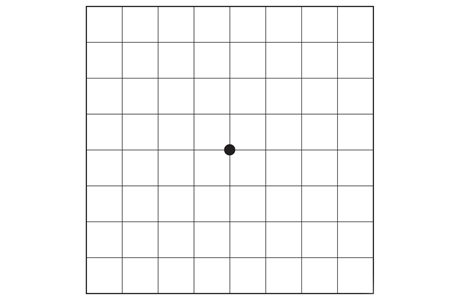 Normal Amsler grid