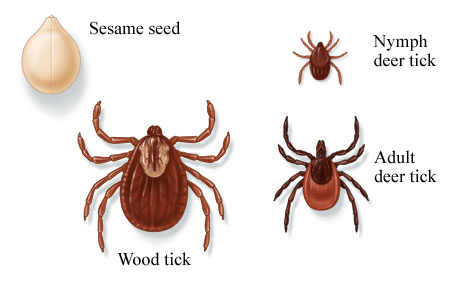 Wood and deer ticks