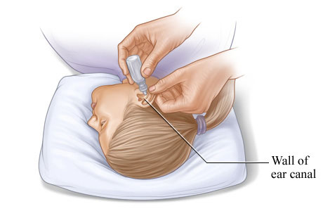 How to insert eardrops safely.