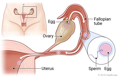 Female reproductive system, with detail of egg passing from ovary to fallopian tube where it is fertilized by sperm