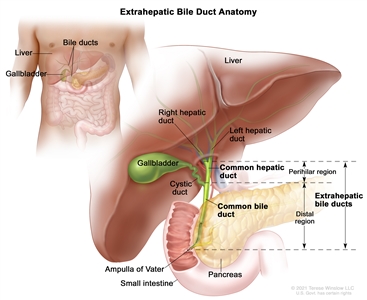 Anatomy of the extrahepatic bile ducts; drawing shows the extrahepatic bile ducts, including the common hepatic duct (perihilar region) and the common bile duct (distal region). Also shown are the liver, right and left hepatic ducts, gallbladder, cystic duct, pancreas, ampulla of Vater, and small intestine.