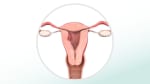 Endometrial cancer: Fast Facts